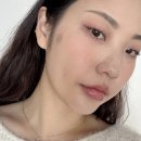 이뻐진개 | 흑자제거 리팟레이저 효과 가격 부작용 솔직후기