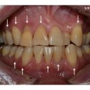 상아플란트치과 이미지