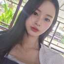 프렌즈의원 | 쁨의원 강남본점 내돈내산 티타늄리프팅 솔직 후기