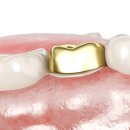 참좋은치과의원 이미지