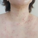 2년전에 쥐젖 40여개 조졌는데 또 올라와서 오늘 가서 100 여개 조지고 왔어요.(비교내용 사진있어요.사진주의) 이미지