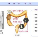 설사 장염에좋은음식 이미지