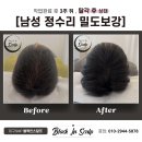 블랙인스칼프
