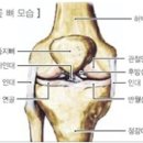 [십자인대파열] 십자인대파열 치료 방법은? 이미지