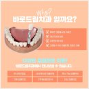 지구치과기공소 이미지