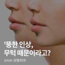 일미리성형외과의원 이미지