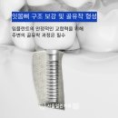 열린치과 이미지