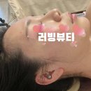 본오2차상가 | 안산피부관리 '러빙뷰티'에서 예비신부 광대, 볼살 고민으로 파워윤곽비대칭관리 받은 후기