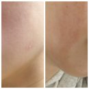 스마트그린에너지(주) | 피부과용 진정 회복템 이손랩 데이즈 스피룰365 그린 수분 크림 사용 후기