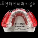 베스트 얼라인 치과기공소 이미지