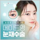 쌍꺼풀재수술후기 설마 이것만은 꼭 확인