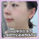 미사피부관리 추천 고원장의모공세척테라피 수분채움 물방울관리 후기