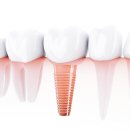 연세가은치과의원 이미지