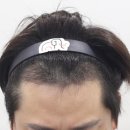 압구정맘모스헤어라인의원 이미지