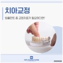 이바른치과교정과치과의원 | 광주 교정치과 추천, 어떤 곳을 선택해야 할까요?