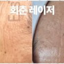더맑은피부 - 동해시 천곡1길 9 | 더맑은피부