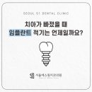 서울에스원치과의원 이미지