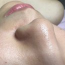 수분주유소 | [수원] 권선동 피부관리샵 윤빛에스테틱&아카데미 수분 각질관리 후기