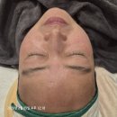 라헨느뷰티샵 | 라헨느뷰티 리프팅관리 후기, 이중턱 정리 & V라인 완성 비포어 애프터 확실해요
