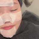 오빛나의원 | 철 불청객 삼총사 모공 + 블랙헤드 + 기미 지워버리기 프로젝트 | 아쿠아필 세안제 기미크림 오빛나의원