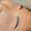 라이모플러스(LYMOPLUS) 이미지