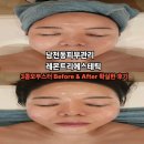 남천동피부관리 3콤보부스터 받고 대 만족한 후기 레몬트리에스테틱