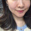 세기스템셀 | [피부] 인천 서창동 스킨올빛 / 안아픈 하이푸 물방울 리프팅 피부관리 전후비교사진 후기