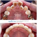 미래디지털교정치과기공소 이미지