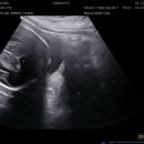 리베르여성병원 이미지