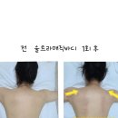 서초구립반포도서관 입구사거리 횡단보도 | 반포피부관리 선에스테스파 반포본점 울트라바디매직 상체관리 후기