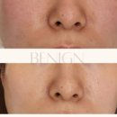 비나인에스테틱 이미지