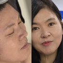 이천 에스테틱 베데스다 물광효과 후기