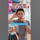 환절기 비염 꿀팁! 막힌코 3초 만에 뚫는 법💯 이미지