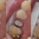 서울안아프게치과의원 이미지