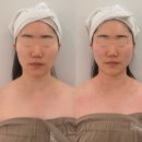 2749 | 압구정무통증윤곽관리로 얼굴 라인 완전 리프팅! 꽁쌤에스테틱 3V윤곽테라피 후기 🩷