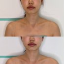해운대 웨딩관리 고운빛깔 해운대점 온.다웨이브 리프팅 윤곽관리 후기