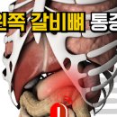 왼쪽 갈비뼈 통증 오른쪽 가슴통증 명치통증 이미지