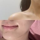 동탄 피부관리 / 동탄 마사지 / 동탄 체형관리 : 호수스킨바디 (윤곽관리 후기)