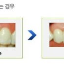 보스톤서울치과 이미지