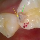 상주치과기공소 이미지