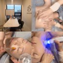 뷰티상점 | 대구 수성구 윤곽관리 추천, 수메르뷰티 성형윤곽A코스 받은 후기