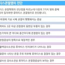 류마티스 관절염이 의심 가는 사람들을 위한 지침서 이미지