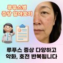 연세류마내과의원 | 부산 해운대구 다치지 않았는데 관절이 아프다면 류마내과 의원 질환 정보