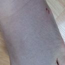 힘센한의원 이미지