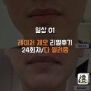 강남역 레이저 제모 고인물 리얼 후기 - 24회차/D+650↑/기계비교/꿀팁/고통/