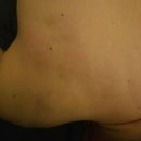 체바스 | 체바스 송도마사지 송도마사지 후기 | 남자친구 편두통·불면증까지 달라진 전신 케어