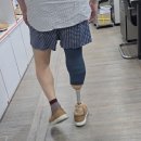 구본교의수족연구센터 | [공지] 의족은 처음부터 선택을 잘해야 고생을 안 합니다.