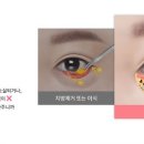 더나처럼성형외과 이미지