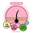 뷰티스스킨