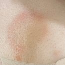 분이양 | [임신기록] 전종관교수님 초진, 일란성쌍둥이 태아보험 가입가능!! / 모자의료협력 핫라인